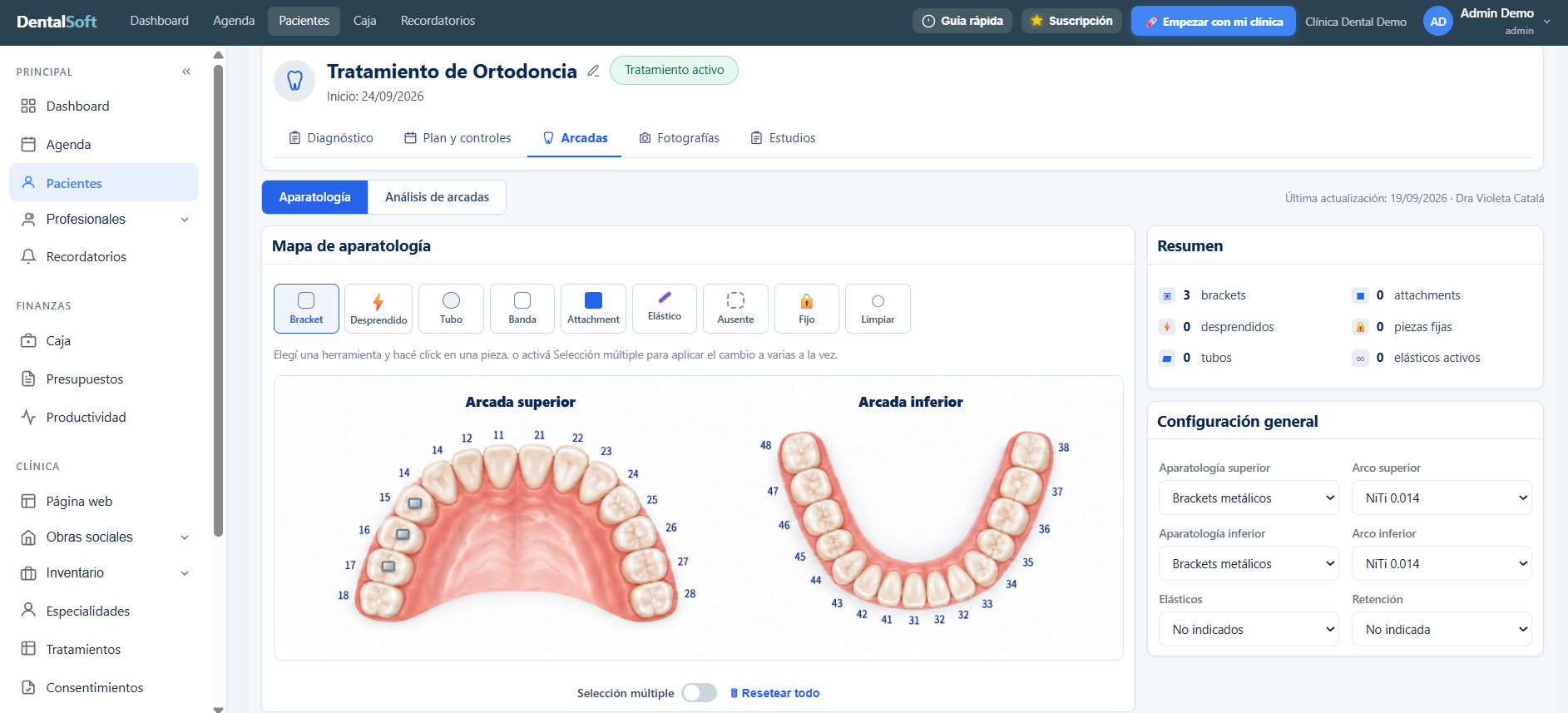 Módulo de ortodoncia de DentalSoft con mapa de aparatología por arcada